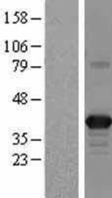 Western Blot: Apolipoprotein L2 Overexpression Lysate [NBL1-07624]