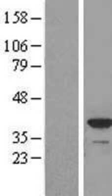 Western Blot: Apolipoprotein L2 Overexpression Lysate [NBL1-07625]