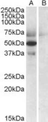 Western Blot: Apolipoprotein L4 Antibody [NBP1-20883]