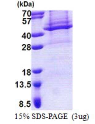 SDS-PAGE: Recombinant Human Apolipoprotein L4 His Protein [NBP2-22692]