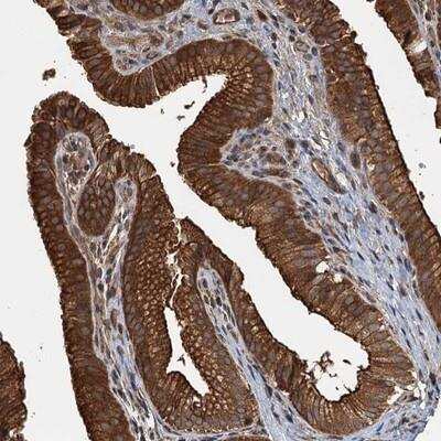 Immunohistochemistry: Apolipoprotein L5 Antibody [NBP1-91675]