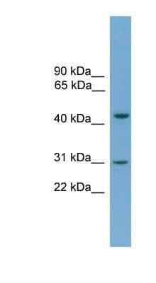 Western Blot: Apolipoprotein L5 Antibody [NBP1-79726]