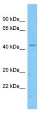 Western Blot: Apolipoprotein L5 Antibody [NBP3-10809]