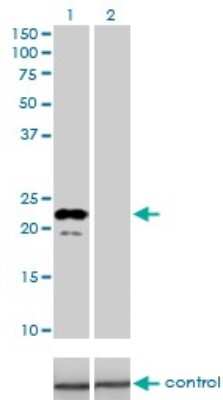 Western Blot: Apolipoprotein M/ApoM Antibody (1F10) [H00055937-M01]