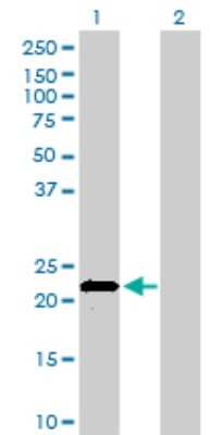 Western Blot: Apolipoprotein M/ApoM Antibody (1F10) [H00055937-M01]