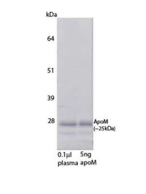 Western Blot: Apolipoprotein M/ApoM Antibody (M5) [NBP3-18287]