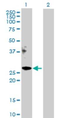 Western Blot: Apolipoprotein M/ApoM Antibody [H00055937-D01P]