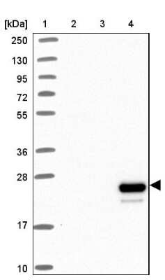 Western Blot: Apolipoprotein M/ApoM Antibody [NBP2-48991]