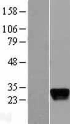 Western Blot: Apolipoprotein M/ApoM Overexpression Lysate [NBL1-07629]