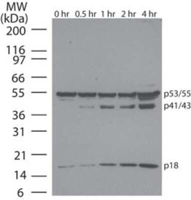 Western Blot: Apoptosis Detection Antibody Pack [NBP2-25080]