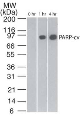 Western Blot: Apoptosis Detection Antibody Pack [NBP2-25080]