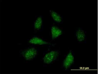 Immunocytochemistry/ Immunofluorescence: Apoptosis enhancing nuclease Antibody [H00064782-B01P]