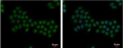 Immunocytochemistry/ Immunofluorescence: Apoptosis enhancing nuclease Antibody [NBP1-31700]