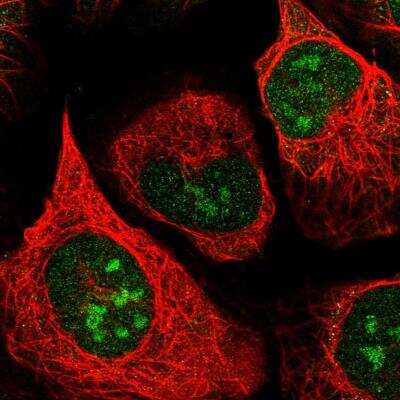Immunocytochemistry/ Immunofluorescence: Apoptosis enhancing nuclease Antibody [NBP2-14272]