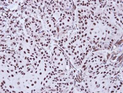 Immunohistochemistry-Paraffin: Apoptosis enhancing nuclease Antibody [NBP1-31700]
