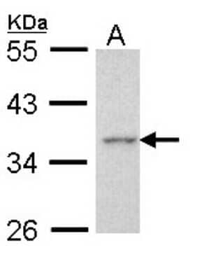 Western Blot: Apoptosis enhancing nuclease Antibody [NBP1-31700]