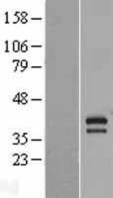 Western Blot: Apoptosis enhancing nuclease Overexpression Lysate [NBL1-12048]