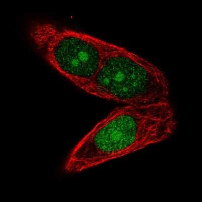 Immunocytochemistry/ Immunofluorescence: Aprataxin Antibody [NBP2-39041]