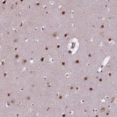 Immunohistochemistry: Aprataxin Antibody [NBP2-39041]