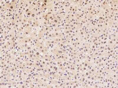Immunohistochemistry-Paraffin: Aprataxin Antibody [NBP2-98661]