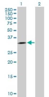 Western Blot: Aprataxin Antibody [H00054840-B01P]