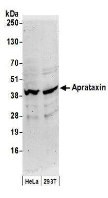 Western Blot: Aprataxin Antibody [NB100-534]