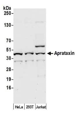 Western Blot: Aprataxin Antibody [NB100-534]