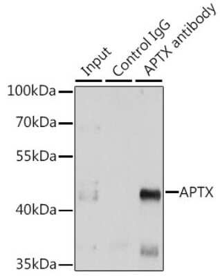 Western Blot: Aprataxin AntibodyBSA Free [NBP2-92693]