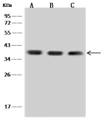 Western Blot: Aprataxin Antibody [NBP2-98661]