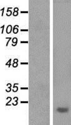 Western Blot: Aprataxin Overexpression Lysate [NBP2-05077]