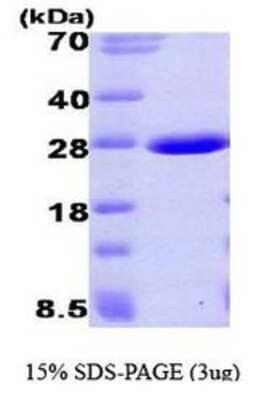 SDS-PAGE: Recombinant Human Aprataxin His Protein [NBP1-40397]