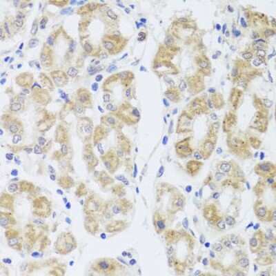 Immunohistochemistry-Paraffin: Aquaporin-0 Antibody - BSA Free [NBP2-92773]