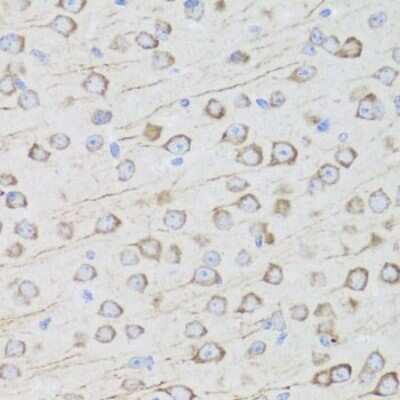 Immunohistochemistry-Paraffin: Aquaporin-0 Antibody - BSA Free [NBP2-92773]