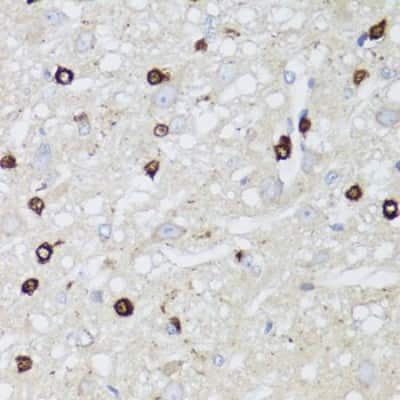 Immunohistochemistry-Paraffin: Aquaporin-0 Antibody - BSA Free [NBP2-92773]