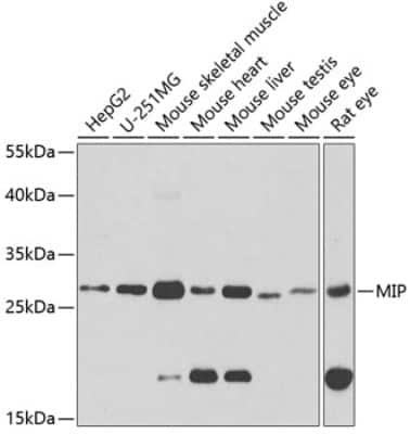 Western Blot: Aquaporin-0 AntibodyBSA Free [NBP2-92773]