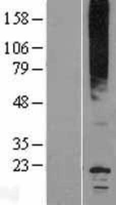 Western Blot: Aquaporin-0 Overexpression Lysate [NBP2-10364]