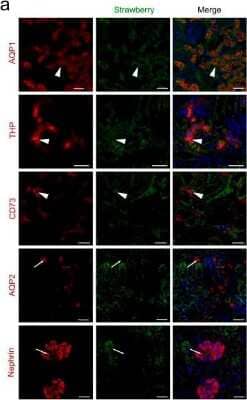 Immunohistochemistry: Aquaporin 1/AQP1 Antibody (1/A5F6) [NB600-749]