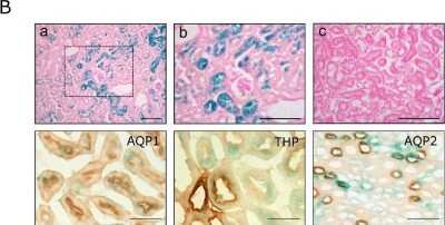 Immunohistochemistry: Aquaporin 1/AQP1 Antibody (1/A5F6) [NB600-749]