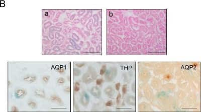 Immunohistochemistry: Aquaporin 1/AQP1 Antibody (1/A5F6) [NB600-749]