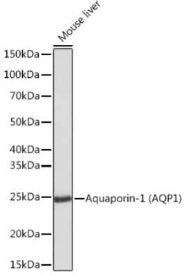 Western Blot: Aquaporin 1/AQP1 Antibody (8V1O3) [NBP3-16354]