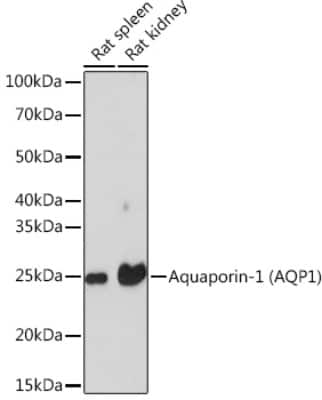 Western Blot: Aquaporin 1/AQP1 Antibody (8V1O3) [NBP3-16354]