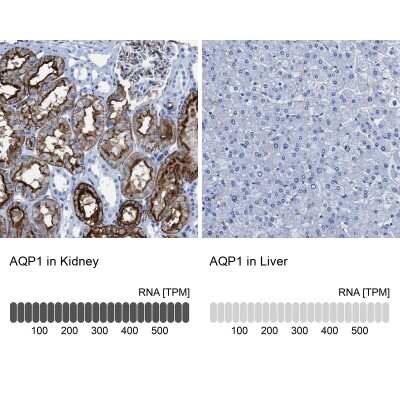 Immunohistochemistry-Paraffin: Aquaporin 1/AQP1 Antibody [NBP1-84488]