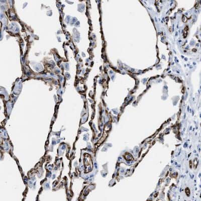 Immunohistochemistry-Paraffin: Aquaporin 1/AQP1 Antibody [NBP1-84488]