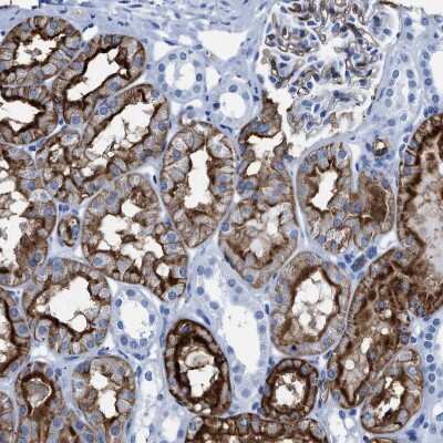 Immunohistochemistry-Paraffin: Aquaporin 1/AQP1 Antibody [NBP1-84488]