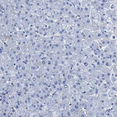 Immunohistochemistry-Paraffin: Aquaporin 1/AQP1 Antibody [NBP1-84488]