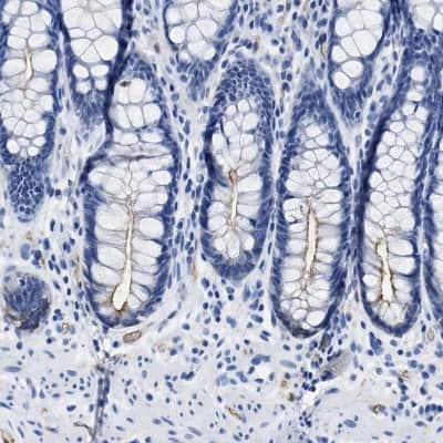 Immunohistochemistry-Paraffin: Aquaporin 1/AQP1 Antibody [NBP1-84488]