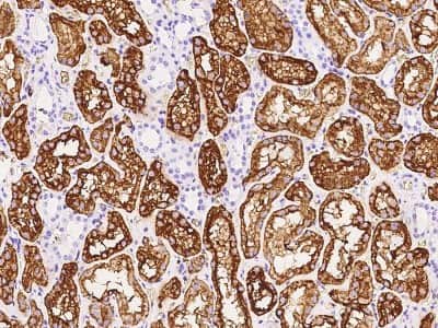 Immunohistochemistry-Paraffin: Aquaporin 1/AQP1 Antibody [NBP2-97583]
