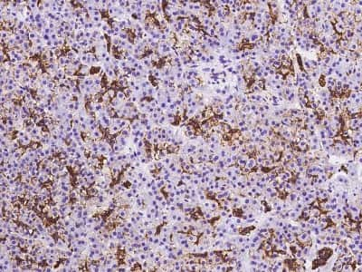 Immunohistochemistry-Paraffin: Aquaporin 1/AQP1 Antibody [NBP2-97583]