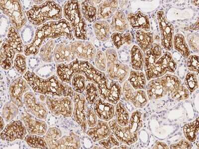 Immunohistochemistry-Paraffin: Aquaporin 1/AQP1 Antibody [NBP2-99068]