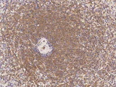 Immunohistochemistry-Paraffin: Aquaporin 1/AQP1 Antibody [NBP2-99068]